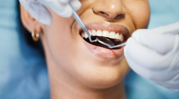 Best Emergency Tooth Extraction in Elkhorn, WI